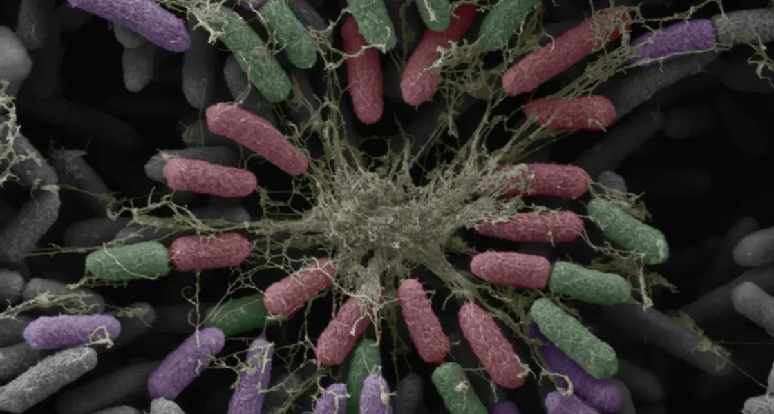 Microscopy image of bacteria and extracellular matrix fibres forming a biofilm that hinders antibiotic drug delivery.