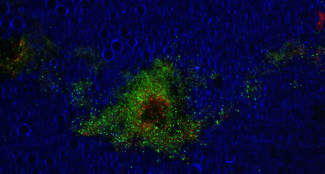 Micro-and nanoencapsulation of antibiotics